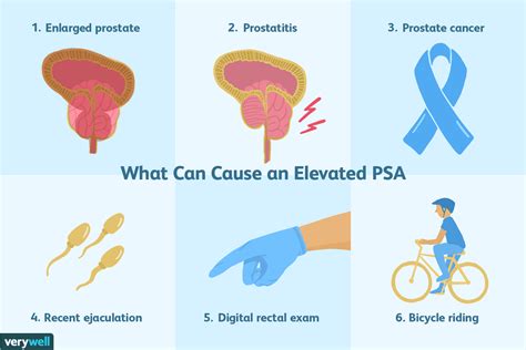 ejaculation during exam|Dos and Don’ts Before a PSA Test 